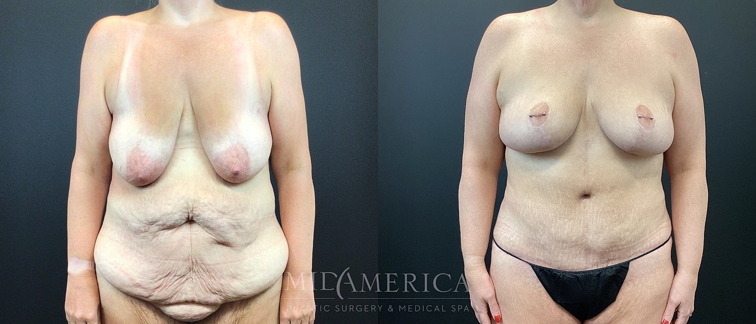 Before and after body transformation images.