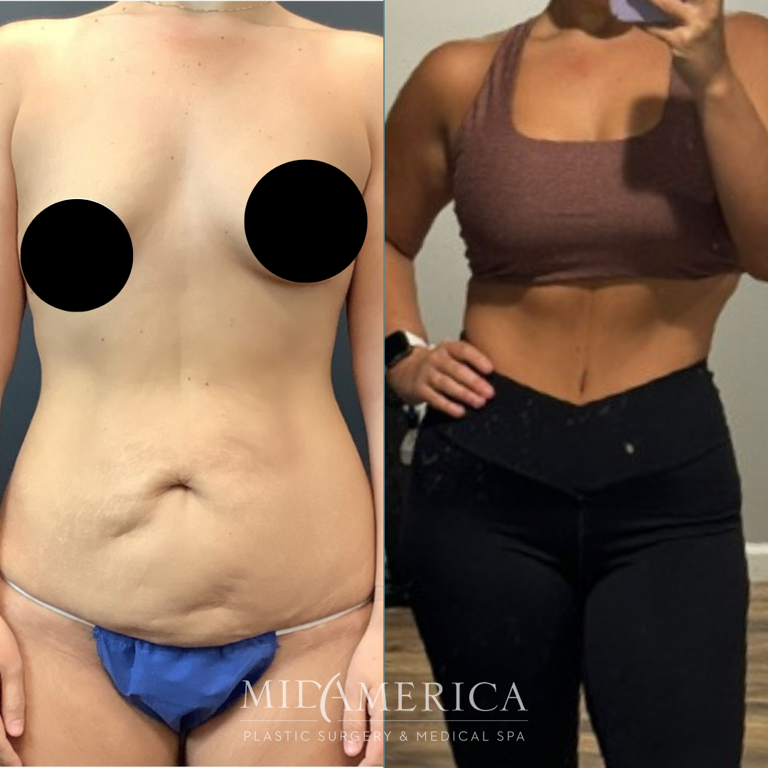 Before and after body transformation image.