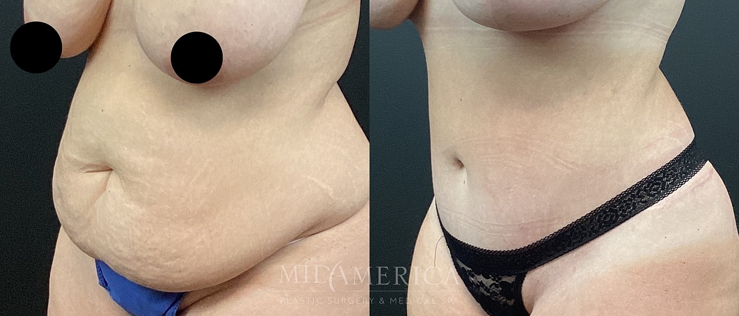 Before and after body transformation results.