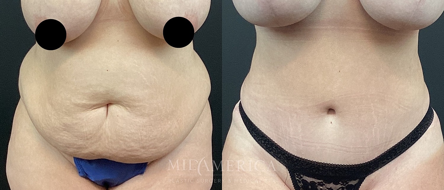 Before and after body transformation results.