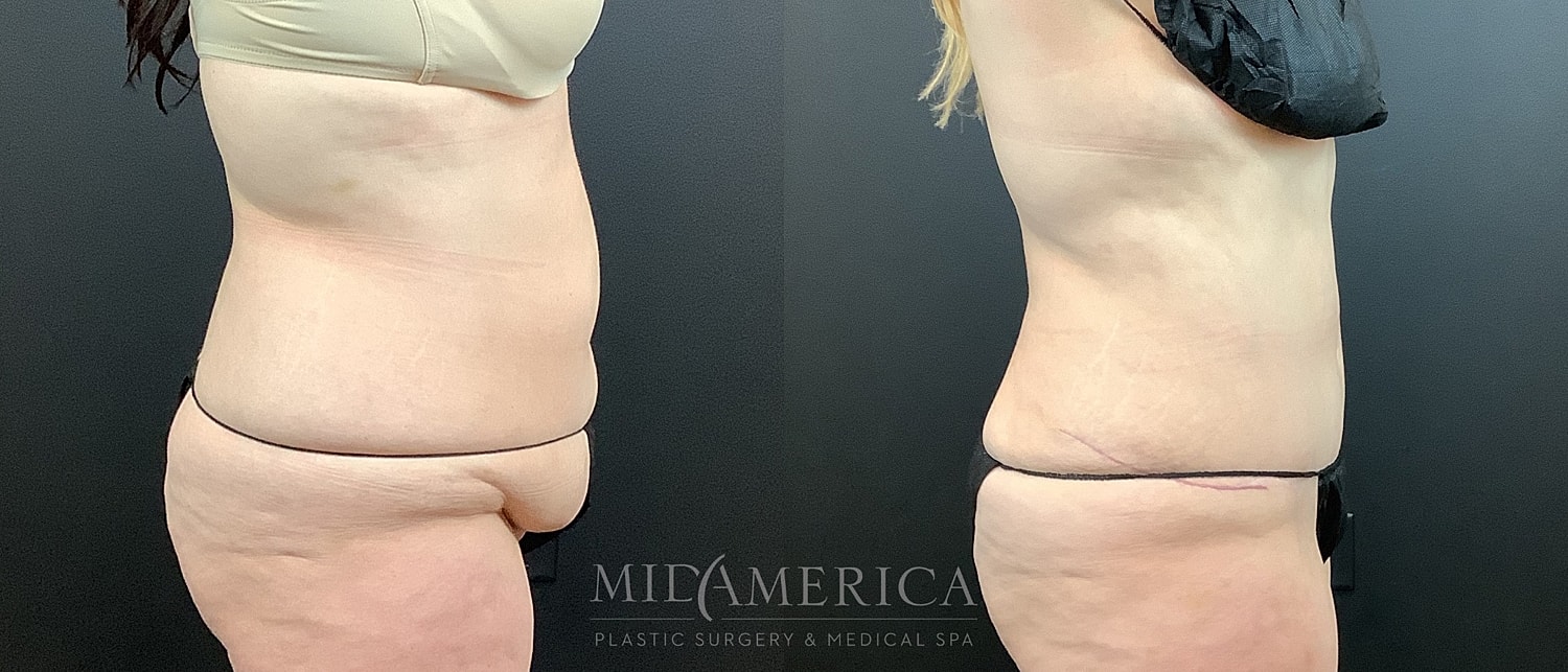 Before and after plastic surgery transformation image.