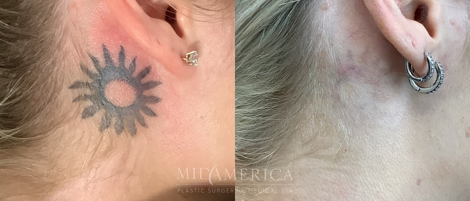 Tattoo and earrings on a person's ear.
