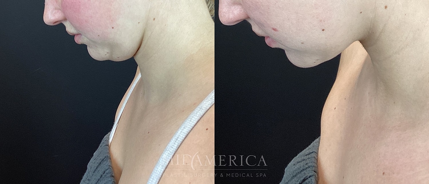 Before and after cosmetic treatment comparison.