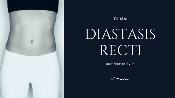 Diastasis Recti (or as society often calls it “the mommy pooch