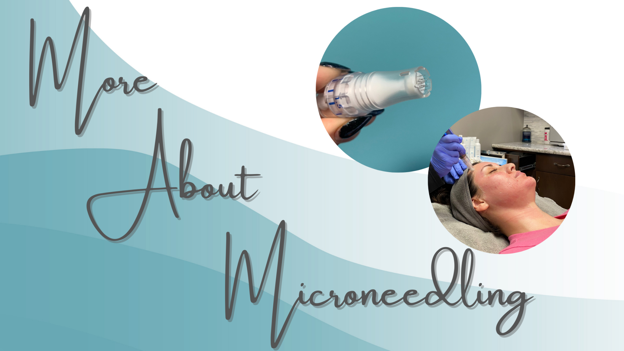 More About Microneedling